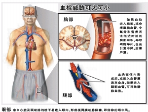医学指导：广州医学院第五附属医院眼科主任、主任医师 张志辉